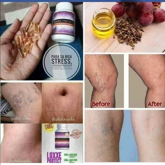 Frontrow Luxxe - Picture 6 of 10